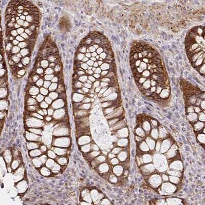 Immunohistochemistry-Paraffin: Integrin alpha 2/CD49b Antibody [NBP2-38902] - Staining of human rectum shows moderate to strong membranous positivity in glandular cells.