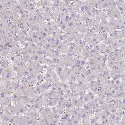 Immunohistochemistry-Paraffin: Integrin alpha 2/CD49b Antibody [NBP2-38995] - Staining of human liver shows no positivity in hepatocytes as expected.