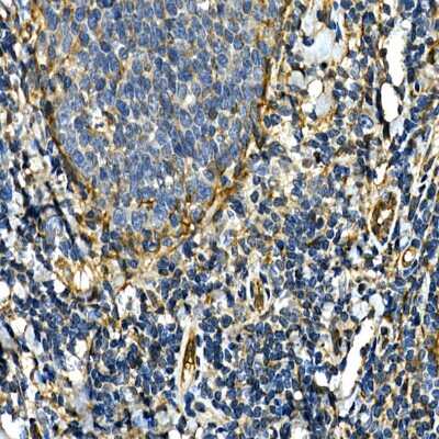 Immunohistochemistry-Paraffin: Integrin alpha 2/CD49b Antibody [NBP3-03851] - Immunohistochemistry of paraffin-embedded human tonsil using [KO Validated] Integrin alpha 2/CD49b Rabbit pAb (NBP3-03851) at dilution of 1:50 (40x lens). Perform high pressure antigen retrieval with 10 mM citrate buffer pH 6.0 before commencing with IHC staining protocol.