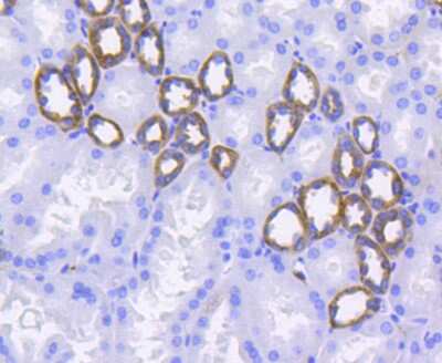 Immunohistochemistry-Paraffin: Integrin alpha 2/CD49b Antibody (SN0752) [NBP2-67691] - Analysis of paraffin-embedded human kidney tissue using anti-ITGA2 antibody. Counter stained with hematoxylin.