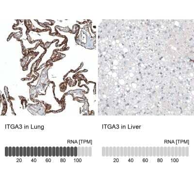 <b>Orthogonal Strategies Validation. </b>Immunohistochemistry-Paraffin: Integrin alpha 3/CD49c Antibody (CL6937) [NBP2-76515] - Analysis in human lung and liver tissues. Corresponding ITGA3 RNA-seq data are presented for the same tissues.