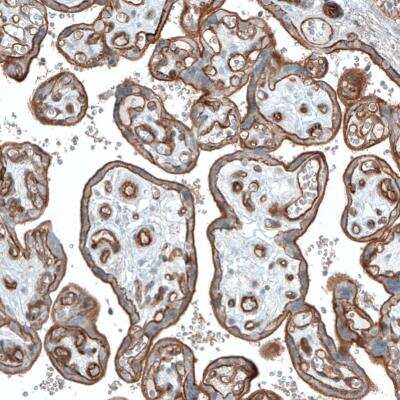 Immunohistochemistry-Paraffin: Integrin alpha 3/CD49c Antibody (CL6937) [NBP2-76515] - Staining of human placenta shows strong membranous positivity in trophoblastic cells.
