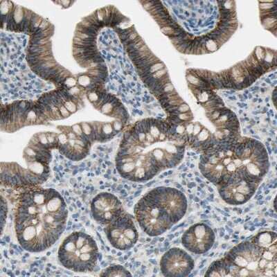 Immunohistochemistry-Paraffin: Integrin alpha 3/CD49c Antibody [NBP2-48514] - Staining of human small intestine shows strong membranous positivity in glandular cells.