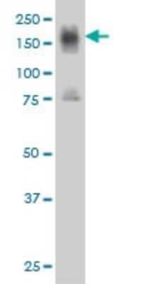Western Blot: Integrin alpha 4/CD49d Antibody (2C11) [H00003676-M01] - ITGA4 monoclonal antibody (M01), clone 2C11 Analysis of ITGA4 expression in Jurkat.