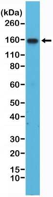 Western Blot: Integrin alpha 4/CD49d Antibody (RM268) [NBP2-61560] - Western Blot of Jurkat cells lysates using NBP2-61560.