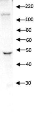 Western Blot: Integrin alpha 4/CD49d Antibody [NBP1-77333] - Western blot analysis of ISE6 (Tick, Ixodes scapularis, cell line) lysate. WB image submitted by a verified customer review.