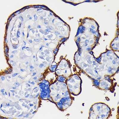 Immunohistochemistry-Paraffin: Integrin alpha 5/CD49e Antibody (8F2O6) [NBP3-15645] - Human placenta using Integrin alpha 5/CD49e (ITGA5/CD49e) Rabbit mAb (NBP3-15645) at dilution of 1:100 (40x lens).Perform microwave antigen retrieval with 10 mM PBS buffer pH 7.2 before commencing with IHC staining protocol.