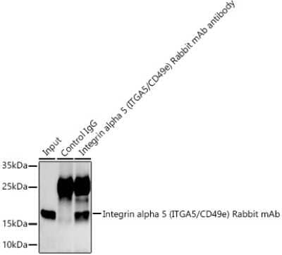 Immunoprecipitation: Integrin alpha 5/CD49e Antibody (8F2O6) [NBP3-15645] - Analysis of 300ug extracts of A549 cells using 3ug Integrin alpha 5/CD49e antibody (NBP3-15645). Western blot was performed from the immunoprecipitate using Integrin alpha 5/CD49e antibody (NBP3-15645) at a dilition of 1:1000.