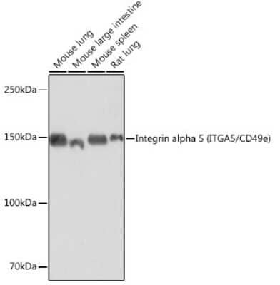 Western Blot: Integrin alpha 5/CD49e Antibody (8F2O6) [NBP3-15645] - Analysis of extracts of various cell lines, using Integrin alpha 5/CD49e (ITGA5/CD49e) antibody (NBP3-15645) at 1:1000 dilution. Secondary antibody: HRP Goat Anti-Rabbit IgG (H+L) at 1:10000 dilution. Lysates/proteins: 25ug per lane. Blocking buffer: 3% nonfat dry milk in TBST. Detection: ECL Basic Kit. Exposure time: 10s.