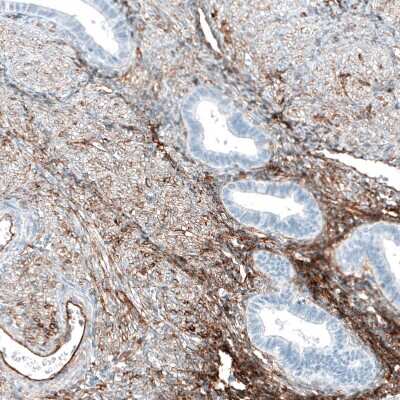 Immunohistochemistry-Paraffin: Integrin alpha 5/CD49e Antibody (CL6940) [NBP2-76518] - Staining of human endometrium shows moderate membranous positivity in smooth muscle cells.