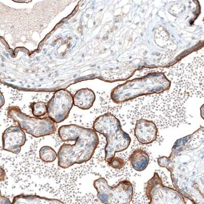 Immunohistochemistry-Paraffin: Integrin alpha 5/CD49e Antibody (CL6945) [NBP2-76519] - Staining of human placenta shows strong apical membrane positivity in trophoblastic cells.