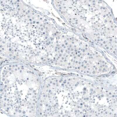 Immunohistochemistry-Paraffin: Integrin alpha 5/CD49e Antibody (CL6945) [NBP2-76519] - Staining of human testis shows no positivity in cells in seminiferous ducts as expected.