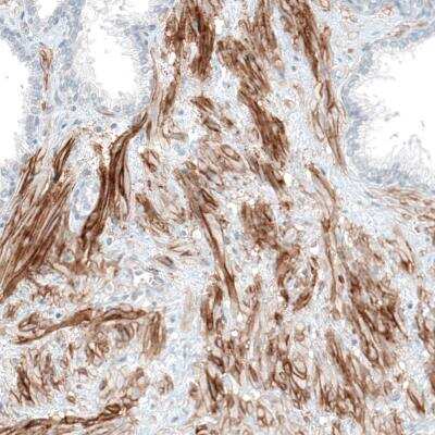 Immunohistochemistry-Paraffin: Integrin alpha 5/CD49e Antibody (CL6945) [NBP2-76519] - Staining of human prostate shows moderate to strong membranous positivity in smooth muscle cells.