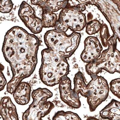 Immunohistochemistry-Paraffin: Integrin alpha 5/CD49e Antibody (CL6951) [NBP2-76520] - Staining of human placenta shows strong positivity in apical membranes of trophoblastic cells.