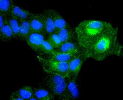 Immunocytochemistry/Immunofluorescence: Integrin alpha 5/CD49e Antibody (JJ08-94) [NBP2-67883] - Staining Integrin alpha 5 in Hela cells (green). The nuclear counter stain is DAPI (blue). Cells were fixed in paraformaldehyde, permeabilised with 0.25% Triton X100/PBS.