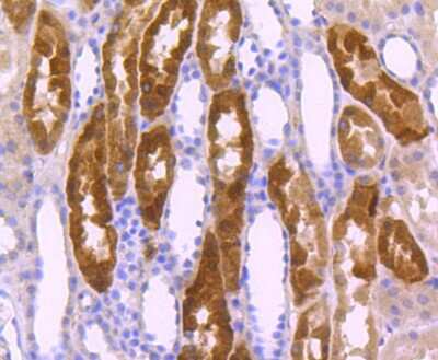 Immunohistochemistry-Paraffin: Integrin alpha 5/CD49e Antibody (JJ08-94) [NBP2-67883] - Analysis of paraffin-embedded human kidney tissue using anti-Integrin alpha 5 antibody. Counter stained with hematoxylin.