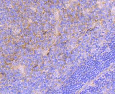 Immunohistochemistry-Paraffin: Integrin alpha 5/CD49e Antibody (JJ08-94) [NBP2-67883] - Analysis of paraffin-embedded human tonsil tissue using anti-Integrin alpha 5 antibody. Counter stained with hematoxylin.