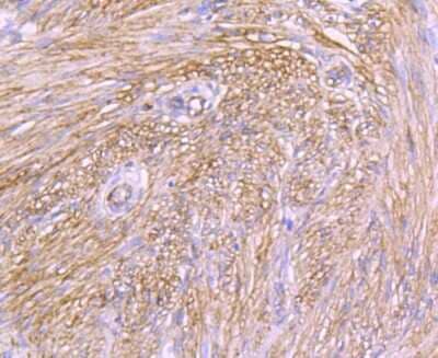 Immunohistochemistry-Paraffin: Integrin alpha 5/CD49e Antibody (JJ08-94) [NBP2-67883] - Analysis of paraffin-embedded human uterus tissue using anti-Integrin alpha 5 antibody. Counter stained with hematoxylin.