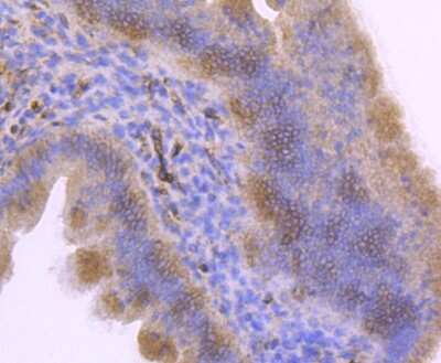 Immunohistochemistry-Paraffin: Integrin alpha 5/CD49e Antibody (JJ08-94) [NBP2-67883] - Analysis of paraffin-embedded mouse uterus tissue using anti-Integrin alpha 5 antibody. Counter stained with hematoxylin.