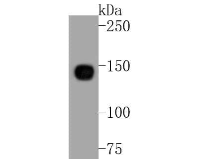 Western Blot: Integrin alpha 5/CD49e Antibody (JJ08-94) [NBP2-67883] - Western blot analysis of Integrin alpha 5/CD49e on NIH/3T3 cell lysates. Proteins were transferred to a PVDF membrane and blocked with 5% BSA in PBS for 1 hour at room temperature. The primary antibody (1/500) was used in 5% BSA at room temperature for 2