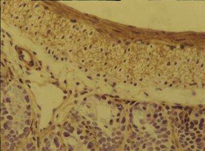 Immunohistochemistry: Integrin alpha 5 beta 1 Antibody (BMC5) [NBP2-29788] - Rat anti-Mouse Integrin alpha5beta1  staining of mouse gut.