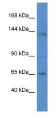 Western Blot: Integrin alpha 7 Antibody [NBP1-74207] - Rat Liver Lysate 1ug/ml Gel Concentration 6-18%