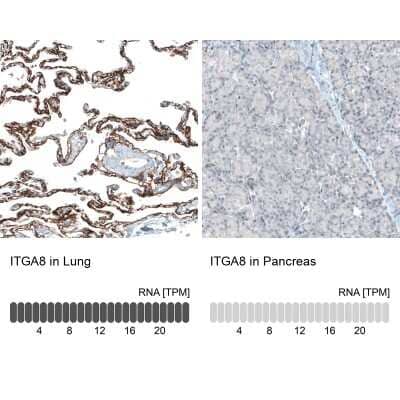 <b>Orthogonal Strategies Validation. </b>Immunohistochemistry-Paraffin: Integrin alpha 8 Antibody (CL7304) [NBP2-76482] - Analysis in human lung and pancreas tissues. Corresponding ITGA8 RNA-seq data are presented for the same tissues.