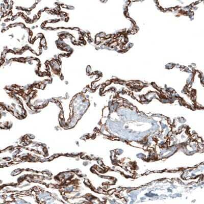 Immunohistochemistry-Paraffin: Integrin alpha 8 Antibody (CL7304) [NBP2-76482] - Staining of human lung shows strong membranous positivity in pneumocytes.