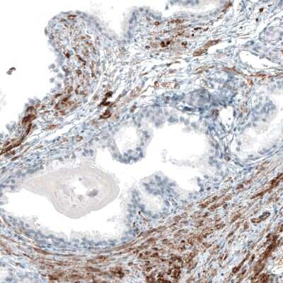 Immunohistochemistry-Paraffin: Integrin alpha 8 Antibody (CL7304) [NBP2-76482] - Staining of human prostate shows moderate to strong positivity in smooth muscle cells.
