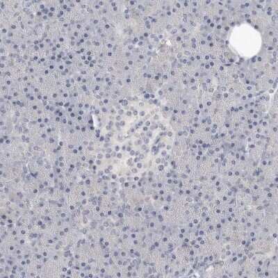 Immunohistochemistry-Paraffin: Integrin alpha D/CD11d Antibody [NBP1-90237] - Staining of human pancreas shows no membranous positivity in exocrine glandular cells as expected.