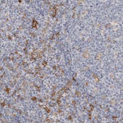Immunohistochemistry-Paraffin: Integrin alpha D/CD11d Antibody [NBP1-90237] - Staining of human tonsil shows moderate membranous positivity in endothelial cells.