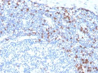 Immunohistochemistry-Paraffin: Integrin alpha E/CD103 Antibody (ITGAE/3904R) [NBP3-07530] - Formalin-fixed, paraffin-embedded human Tonsil stained with Integrin alpha E/CD103 Recombinant Rabbit Monoclonal Antibody (ITGAE/3904R).