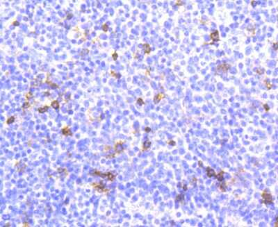 Immunohistochemistry-Paraffin: Integrin alpha E/CD103 Antibody (SN62-06) [NBP2-67663] - Analysis of paraffin-embedded human tonsil tissue using anti-Integrin alpha E antibody. Counter stained with hematoxylin.