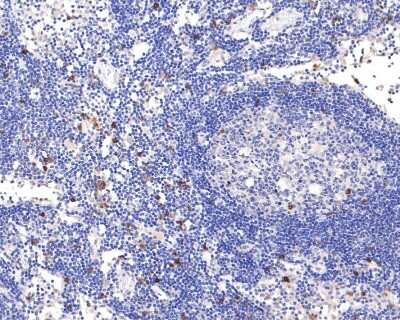 Immunohistochemistry-Paraffin: Integrin alpha E/CD103 Antibody (SN62-06) [NBP2-67663] - Analysis of paraffin-embedded human lymph node tissue using anti-Integrin alpha E/CD103 antibody. The section was pre-treated using heat mediated antigen retrieval with Tris-EDTA buffer (pH 9.0) for 20 minutes. The tissues were blocked in 1% BSA for 30 minutes at room temperature, washed with ddH2O and PBS, and then probed with the primary antibody (1/400) for 30 minutes at room temperature. The detection was performed using an HRP conjugated compact polymer system. DAB was used as the chromogen. Tissues were counterstained with hematoxylin and mounted with DPX.