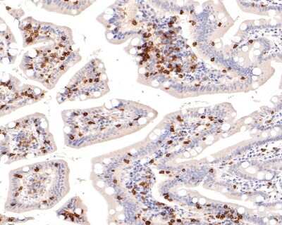 Immunohistochemistry-Paraffin: Integrin alpha E/CD103 Antibody (SN62-06) [NBP2-67663] - Analysis of paraffin-embedded human small intestine tissue using anti-Integrin alpha E antibody. The section was pre-treated using heat mediated antigen retrieval with Tris-EDTA buffer (pH 9.0) for 20 minutes.The tissues were blocked in 1% BSA for 30 minutes at room temperature, washed with ddH2O and PBS, and then probed with the primary antibody (1/400) for 30 minutes at room temperature. The detection was performed using an HRP conjugated compact polymer system. DAB was used as the chromogen. Tissues were counterstained with hematoxylin and mounted with DPX.
