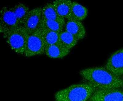 Immunocytochemistry/Immunofluorescence: Integrin alpha L/CD11a Antibody (SC56-01) [NBP2-67551] - Staining CD11a in HepG2 cells (green). The nuclear counter stain is DAPI (blue). Cells were fixed in paraformaldehyde, permeabilised with 0.25% Triton X100/PBS.