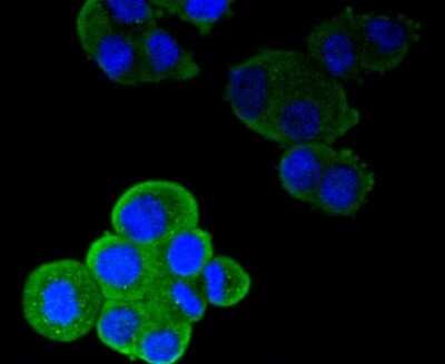 Immunocytochemistry/Immunofluorescence: Integrin alpha L/CD11a Antibody (SC56-01) [NBP2-67551] - Staining CD11a in SW480 cells (green). The nuclear counter stain is DAPI (blue). Cells were fixed in paraformaldehyde, permeabilised with 0.25% Triton X100/PBS.