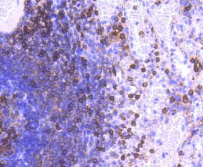 Immunohistochemistry-Paraffin: Integrin alpha L/CD11a Antibody (SC56-01) [NBP2-67551] - Analysis of paraffin-embedded human spleen tissue using anti-CD11a antibody. Counter stained with hematoxylin.