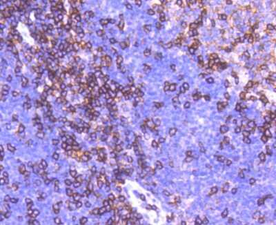 Immunohistochemistry-Paraffin: Integrin alpha L/CD11a Antibody (SC56-01) [NBP2-67551] - Analysis of paraffin-embedded human tonsil tissue using anti-CD11a antibody. Counter stained with hematoxylin.