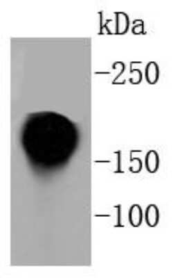 Western Blot: Integrin alpha L/CD11a Antibody (SC56-01) [NBP2-67551] - Analysis of CD11a on Jurkat cell lysates using anti-CD11a antibody at 1/1,000 dilution.