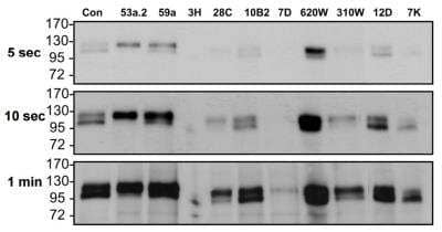 Immunoprecipitation: Integrin alpha V beta 6 Antibody (AvB6 53a.2) [NBP2-50449] - avb6 was immunoprecipitated with rat mAbs and western blotted for B6 with C19 antibody. Film was then exposed for different time exposures. The control lane was DX3puroB6 lysate. 59A, 10B2, 620W and 12D shows a very good result in revealing the double band for β6 by 5 seconds, and 53a2 shows only the upper band of B6. By 1 minute, most rat mAbs reveal a B6 immunoprecipitate. Data are from one of three separate experiments.