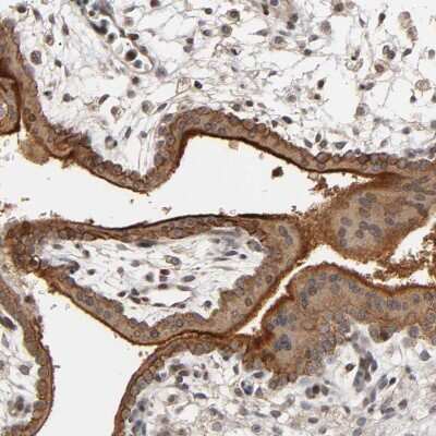 Immunohistochemistry-Paraffin: Integrin alpha V/CD51 Antibody [NBP1-85746] - Staining of human placenta shows strong cytoplasmic and membranous positivity in trophoblastic cells.