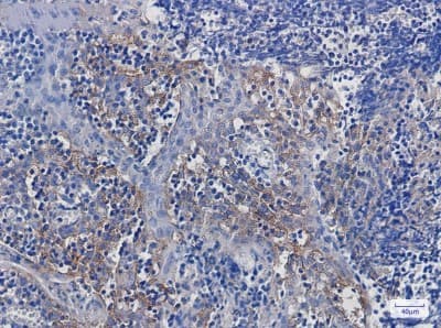 Immunohistochemistry-Paraffin: Integrin alpha V/CD51 Antibody (S03-6E3) [NBP3-19510] - Immunohistochemistry of Integrin alpha V/CD51 in paraffin-embedded Human tonsil using NBP3-19510 at dilution 1/100