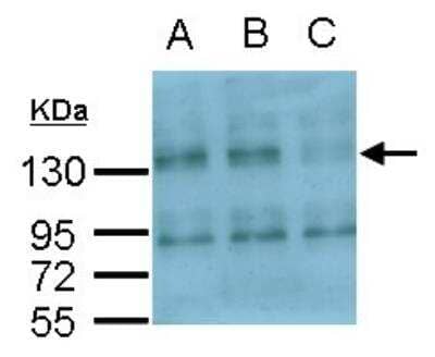 Western Blot: Integrin alpha V/CD51 Antibody [NBP2-16973] - Sample (30 ug of whole cell lysate) A: RD (Rhabdomyosarcoma) cell (Mock control) B: RD transfected scramble siRNA C: RD transfected ITGAV siRNA 8% SDS PAGE gel, diluted at 1:900.