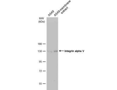 Western Blot: Integrin alpha V/CD51 Antibody [NBP2-16973] - A549 whole cell and membrane extracts (30 ug) were separated by 7.5% SDS-PAGE, and the membrane was blotted with Integrin alpha V antibody [C2C3], C-term diluted at 1:500. The HRP-conjugated anti-rabbit IgG antibody (NBP2-19301) was used to detect the primary antibody, and the signal was developed with Trident ECL plus-Enhanced.