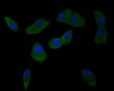Immunocytochemistry/Immunofluorescence: Integrin alpha V beta 3 Antibody (SC56-07) [NBP2-67557] - ICC staining of Integrin alpha V beta 3 in A549 cells (green). Formalin fixed cells were permeabilized with 0.1% Triton X-100 in TBS for 10 minutes at room temperature and blocked with 1% Blocker BSA for 15 minutes at room temperature. Cells were probed w