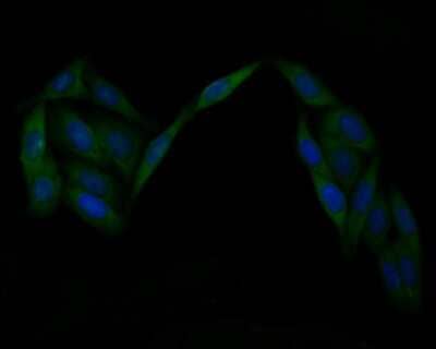 Immunocytochemistry/Immunofluorescence: Integrin alpha V beta 3 Antibody (SC56-07) [NBP2-67557] - ICC staining of Integrin alpha V beta 3 in SiHa cells (green). Formalin fixed cells were permeabilized with 0.1% Triton X-100 in TBS for 10 minutes at room temperature and blocked with 1% Blocker BSA for 15 minutes at room temperature. Cells were probed w