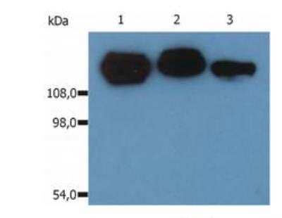 Western Blot: Integrin beta 1/CD29 Antibody (MEM-101A) [Biotin] [NB110-81701] - Western Blotting analysis (non-reducing conditions) of isolated peripheral blood lymphocytes of various species using anti-CD29 (MEM-101A).Lane 1: lysate of human PBLLane 2: lysate of canine PBLLane 3: lysate of porcine PBL