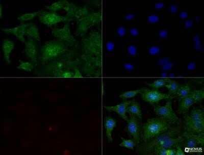 Immunocytochemistry/Immunofluorescence: Integrin beta 1/CD29 Antibody (P4C10) - Azide and BSA Free [NBP2-80818] - Integrin beta 1 (P4C10) antibody was tested in -20 degree MeOH fixed HeLa cells at a 1:200 dilution against DyLight 488 (green). Actin and nuclei were counterstained against Phalloidin 568 (red) and DAPI (blue), respectively. Image from the standard format of this antibody.