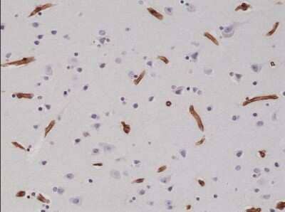 Immunohistochemistry-Paraffin: Integrin beta 1/CD29 Antibody (RM285) [NBP2-61561] - Immunohistochemical staining of formalin fixed and paraffin embedded human brain tissue sections using NBP2-61561.